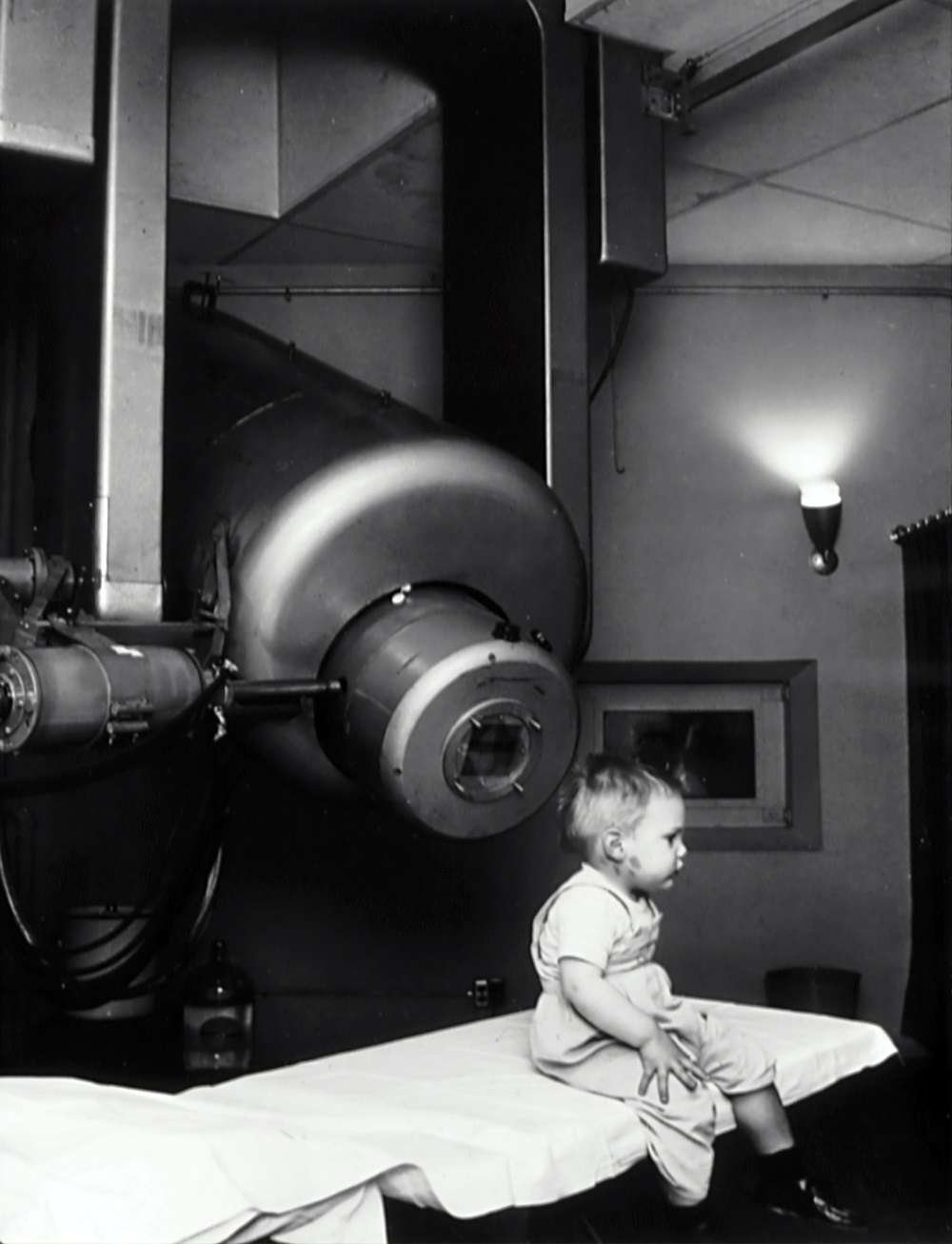 Gordon Isaacs, the first patient treated with the linear accelerator (radiation therapy)