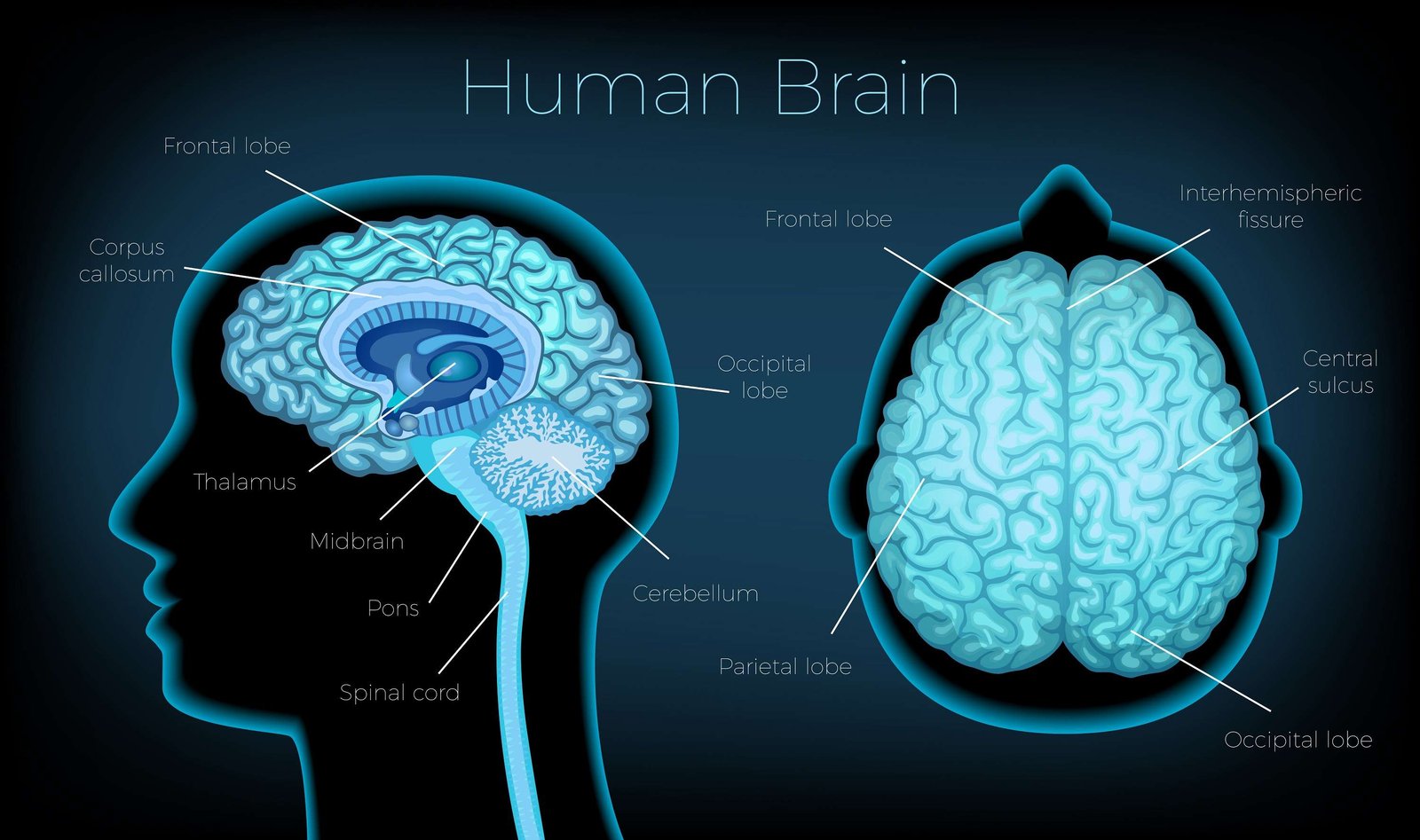 Brain image